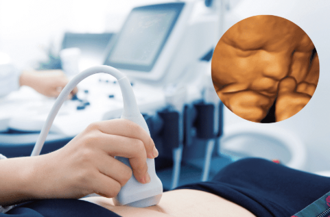 Ultrasound Imaging