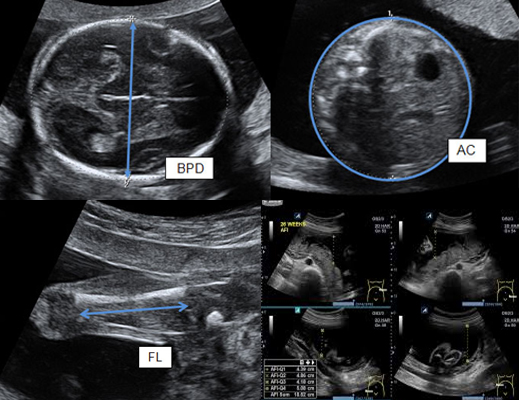 Pregnancy Scanning